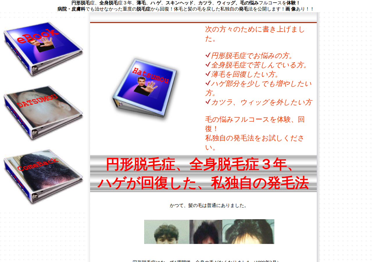 ハゲ頭★巨大画像公開★円形脱毛症、全身脱毛症3年、ハゲが回復した私独自の発毛法