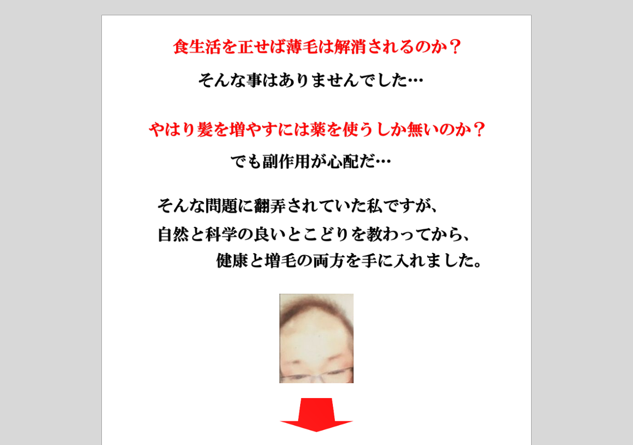 育毛サーファー －髪の自由を手にする市民革命－