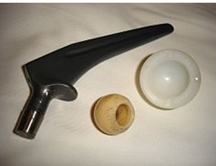 股関節痛から脱却して楽になった69歳♀の実録体験記 ＜股関節痛からの脱却プラン＞